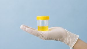 How Long Does Cocaine Stay in Your System Urine, Blood, Hair & Saliva Timelines hero image of someone holding a urine sample.