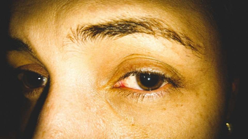 What Is the Drug Ice its a drug that can cause quick symptoms like enlarged pupils and mood swings.