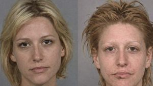 crystal meth images from public sources like mugshots show the progression of meth use over time.