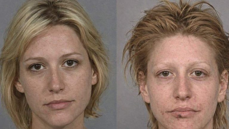 crystal meth images from public sources like mugshots show the progression of meth use over time.