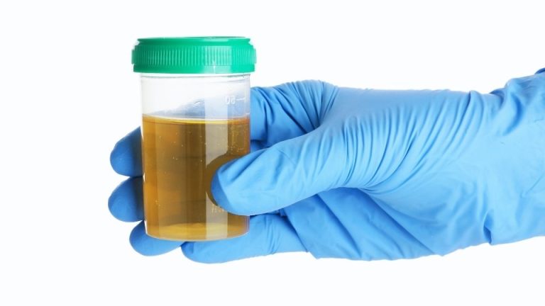 Does Promethazine Show Up on a Drug Test hero image of a urine test.