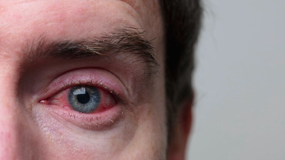 How to Tell If Someone Is Using Drugs someone's eyes may reveal they have been using.
